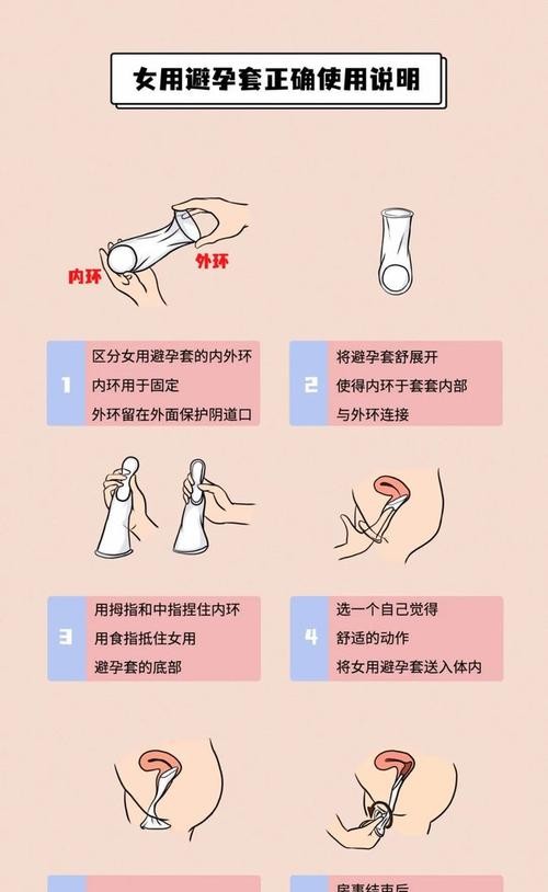 女用避孕套的真实体验：感觉真的不一样吗？